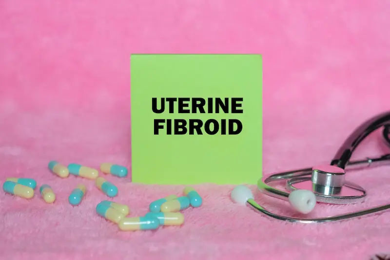 Your Guide to Uterine Fibroid Treatment Options & How to Choose